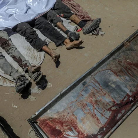 25 lond krevja, at kríggið í Gaza støðgar