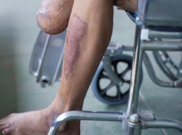 (Mynd: Granskingarráðiå)